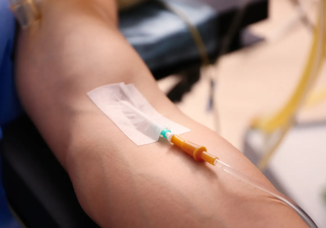 Kroplówki witaminowe Toruń: przedramię z kaniulą i przezroczystym opatrunkiem